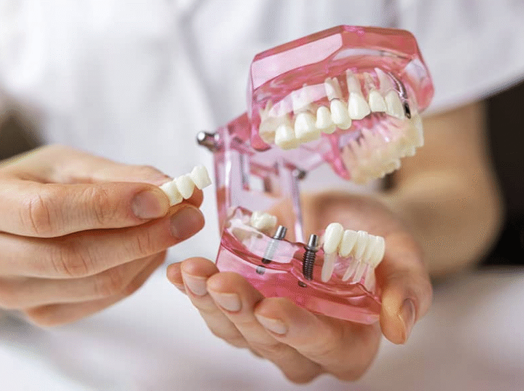 Innovative Lösungen für die Zahnkorrektur und Zahnersatz